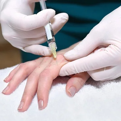 Hand Rejuvenation in Islamabad