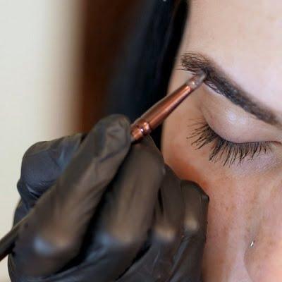 Hair Transplants for Beard and Eyebrow Restoration