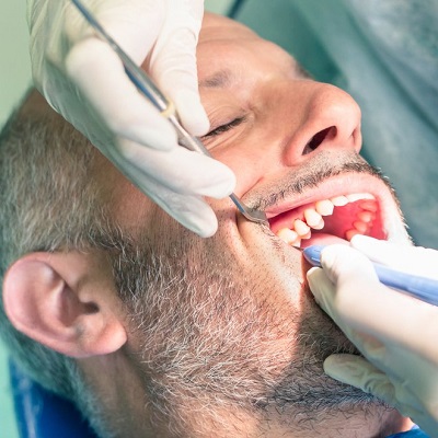 root canal treatment in Islamabad