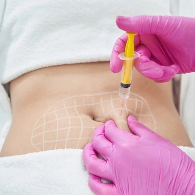 How long do fat melting injections take to work