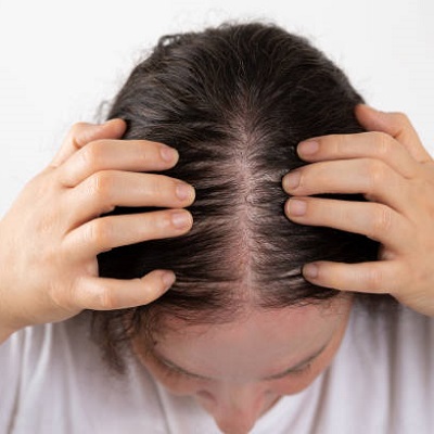 Why am i losing so much hair suddenly | hair loss