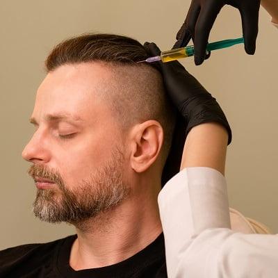 PRP hair treatment price in islamabad