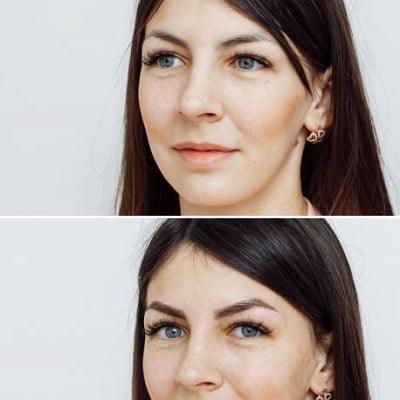 Effects of Microblading