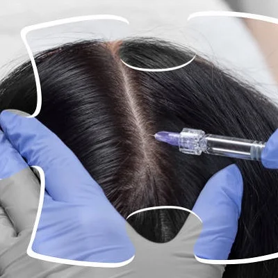 Hair Fillers Treatment FAQs