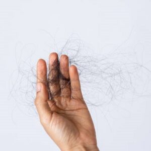 How To Manage Seasonal Hair Loss in Winter?