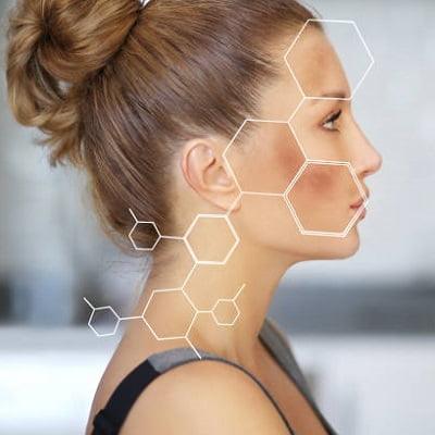 Types of Hyperpigmentation