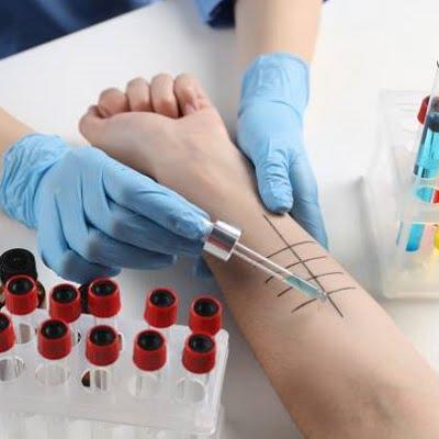 Do’s and Don’ts When Taking Glutathione Injections