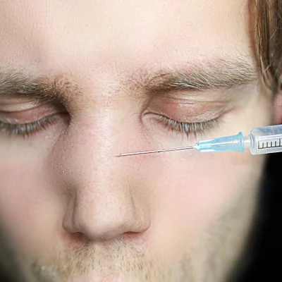 How long does nonsurgical Rhinoplasty last