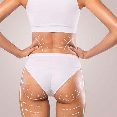 Brazilian Butt Lift Cost in Islamabad