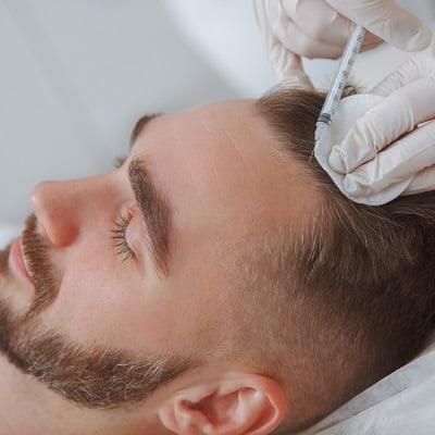 Cheapest PRP Treatment in Islamabad, Pakistan