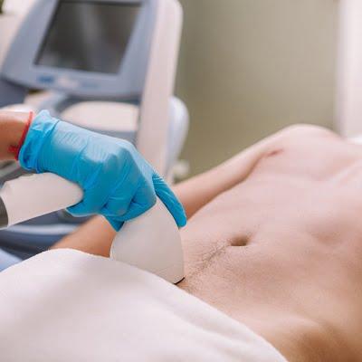Is laser hair removal safe for the pubic area?