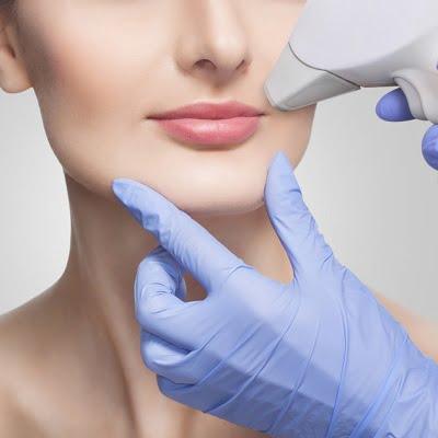 U-Lips & Chin Laser Hair Removal Cost in Islamabad