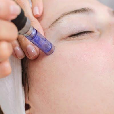 What Is the Optimal Care for Skin After Microneedling