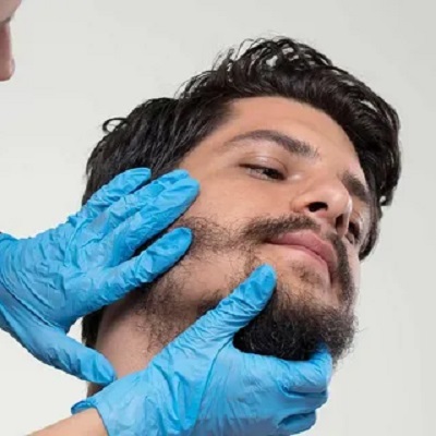 Should I shave before beard hair transplant