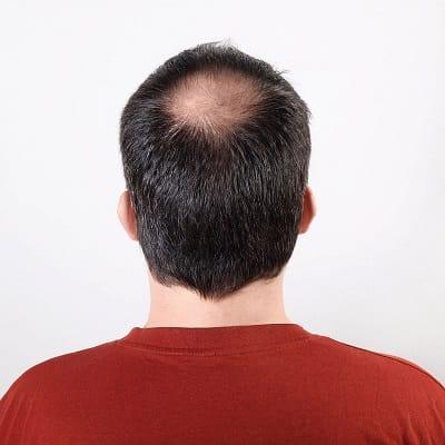 How Can I Make Crown Hair Grow Faster