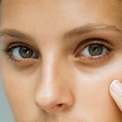 Do Eye Bags Grow Back