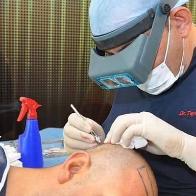 Hair Transplant Cost in Islamabad, Pakistan 2024