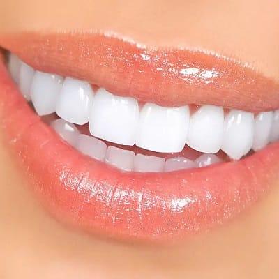 Zirconia Teeth Price in Islamabad