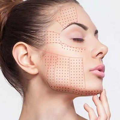 Can I put on moisturizer after the HIFU treatment?