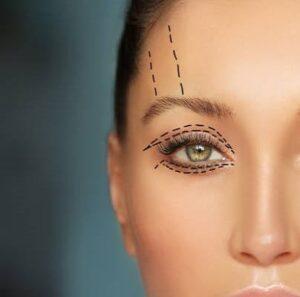 Can Men Get Eyelid Surgery?