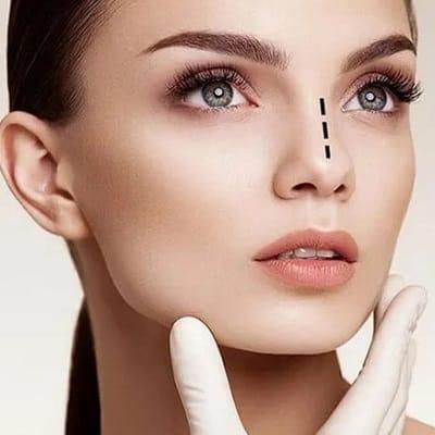 How Long After Septoplasty Can I Shower?