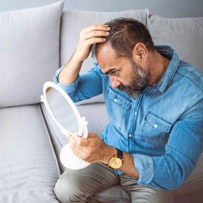 Male Pattern Baldness Treatment in Islamabad, Pakistan