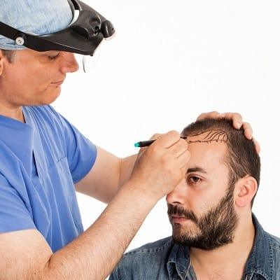 Are Crowns Still Thin After Transplant in Islamabad?