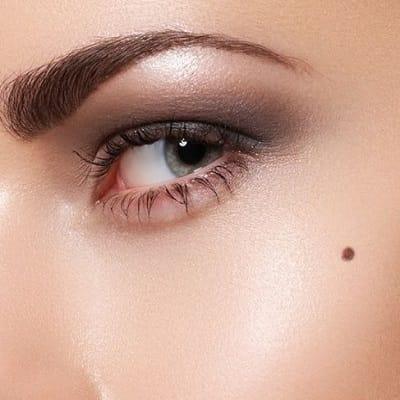 How Painful Is Mole Removal in Islamabad?