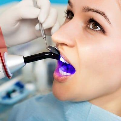 What Is the Cost of Teeth Filling in Islamabad, Pakistan?