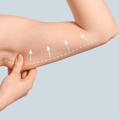 Can I Still Build Muscle in My Arms After Surgery?