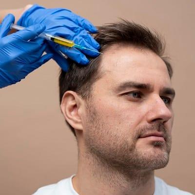Can Men Also Get Hair Fillers in Islamabad?