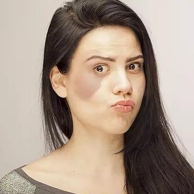 Can lasers treat all pigmented birthmarks?