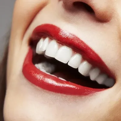 Crowded Teeth Treatment in Islamabad, Pakistan