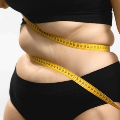 Best Bariatric Surgeon in Islamabad