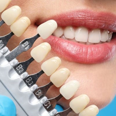 Dental Implants Clinic in Islamabad