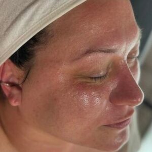 How soon can I wash my hair after the exosomes treatment?