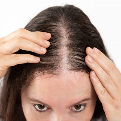 Exosomes for Hair Loss Price in Pakistan