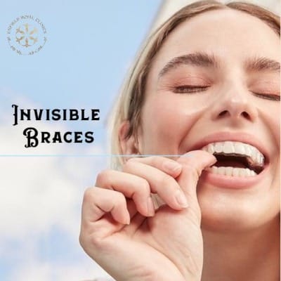 Invisible Braces in Islamabad