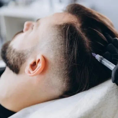 What Is the Price of Hair Mesotherapy in Islamabad