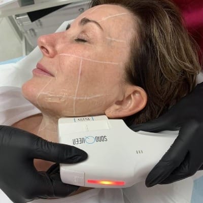 What is the Price of HIFU Treatment in Islamabad