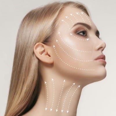 Can I get a non-surgical facelift after Botox or fillers