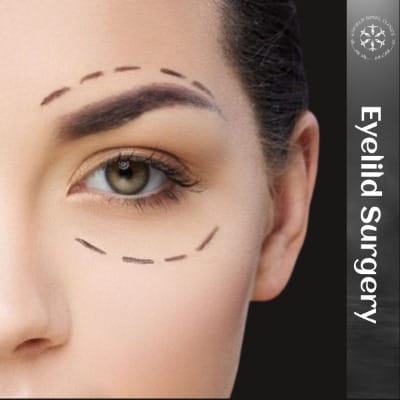 Eyelid Surgery In Islamabad