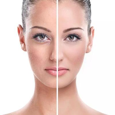 How Expensive is Skin Rejuvenation in Islamabad