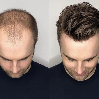 How much Hair wigs cost in Islamabad