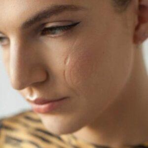 How much do Facial Scar Revision cost in Islamabad