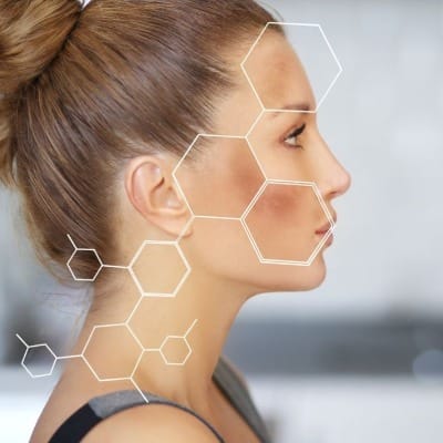 Mesotherapy for Melasma Price in Pakistan