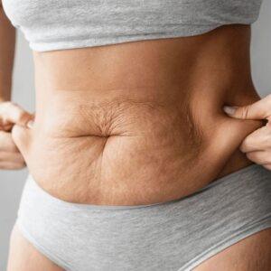 Saggy skin surgery cost in Islamabad