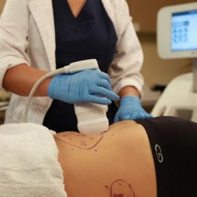 Affordable Lipomatic Treatment Cost in Islamabad