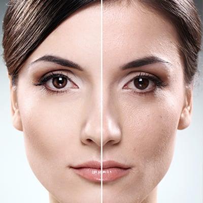 How Much Does Skin Lesion Removal Cost in Pakistan