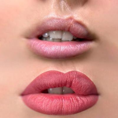 Is surgery the only option for cleft lip and palate